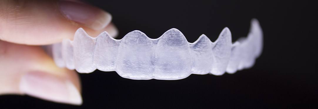 Pomona Clear Aligners