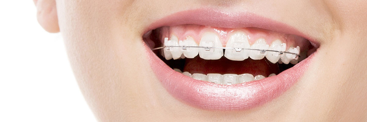Pomona Invisible Orthodontics