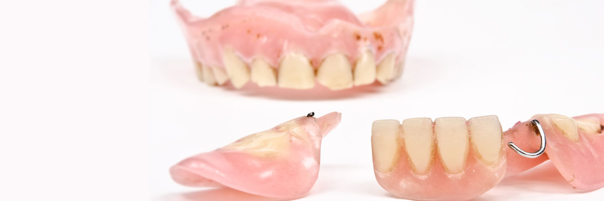 Pomona What Do I Do If I Damage My Dentures?