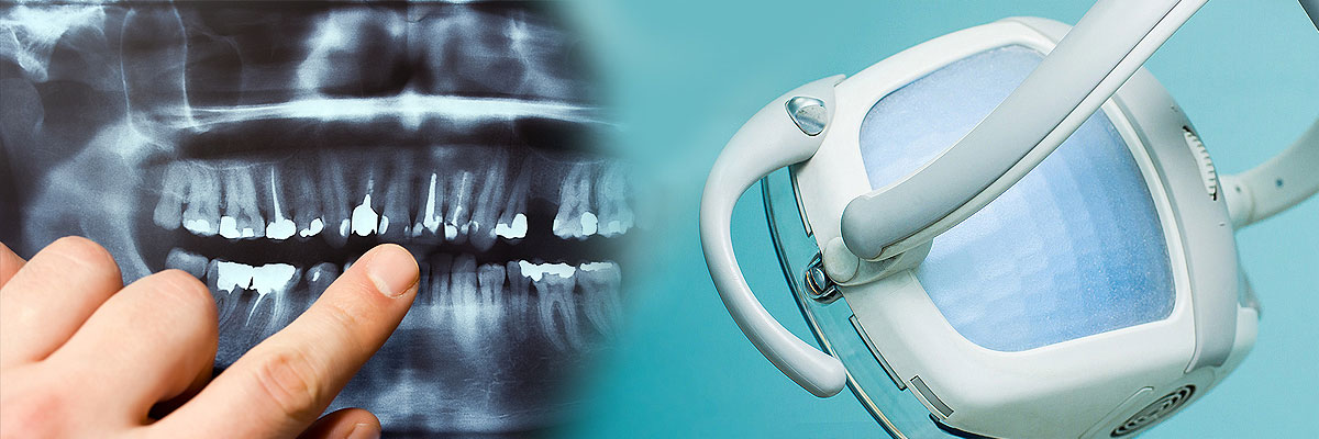 Pomona Dental Cleaning
