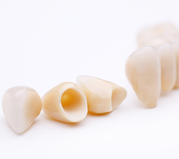Pomona Dental Crowns and Dental Bridges