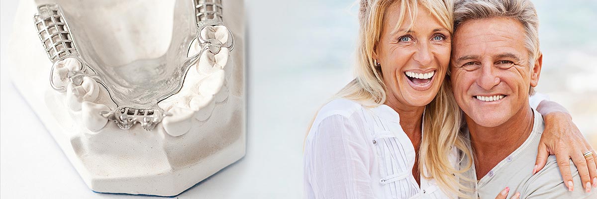 Pomona Implant Supported Dentures