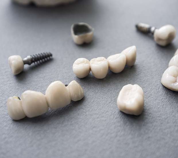 Pomona The Difference Between Dental Implants and Mini Dental Implants