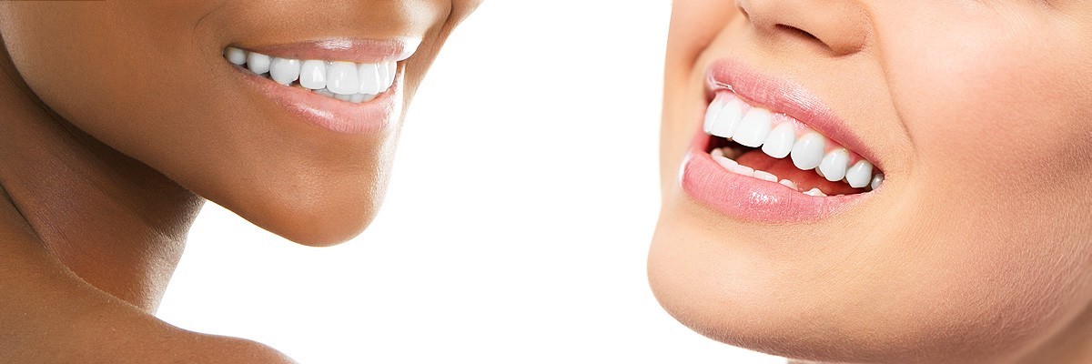 Pomona Improve Your Smile for Senior Pictures