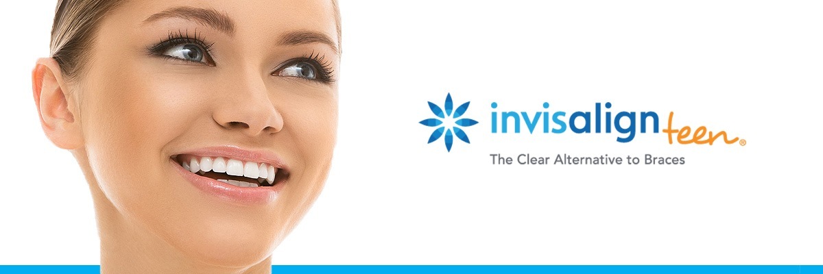 Pomona Invisalign vs Traditional Braces