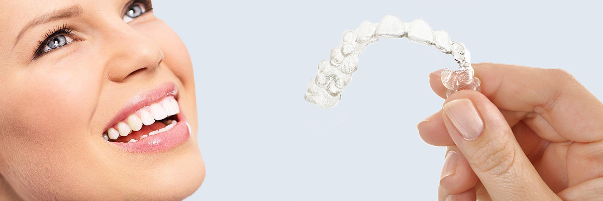 Pomona 7 Things Parents Need to Know About Invisalign Teen