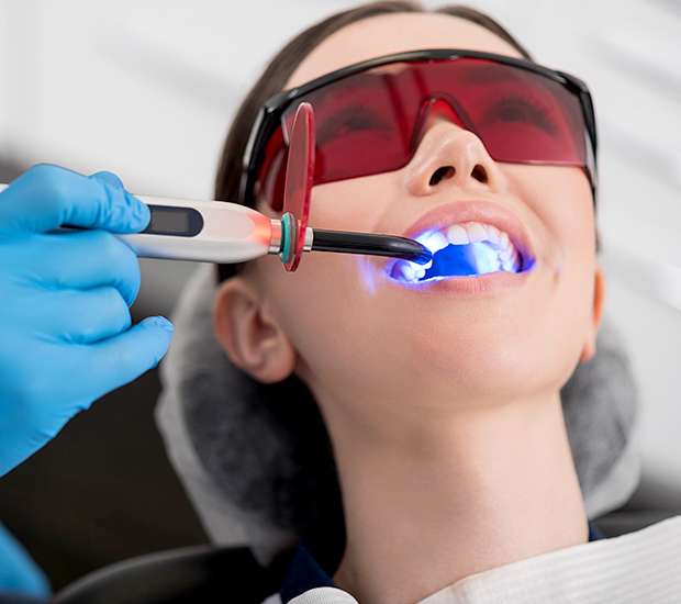 Pomona Professional Teeth Whitening