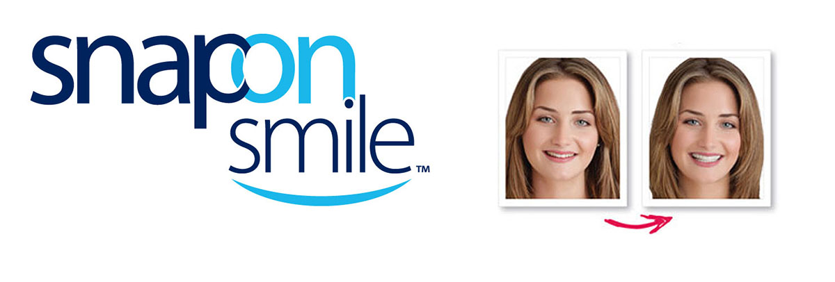 Pomona Snap-On Smile