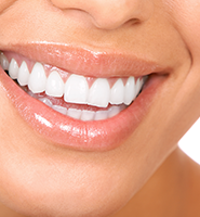 Teeth Whitening Services Pomona, CA