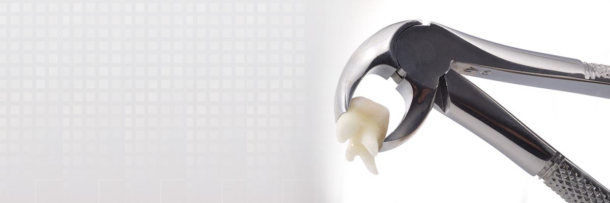 Pomona Tooth Extraction