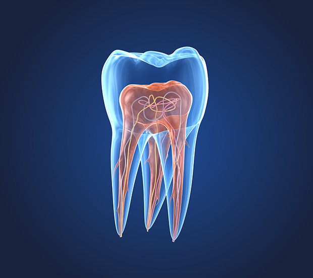 Pomona What is an Endodontist