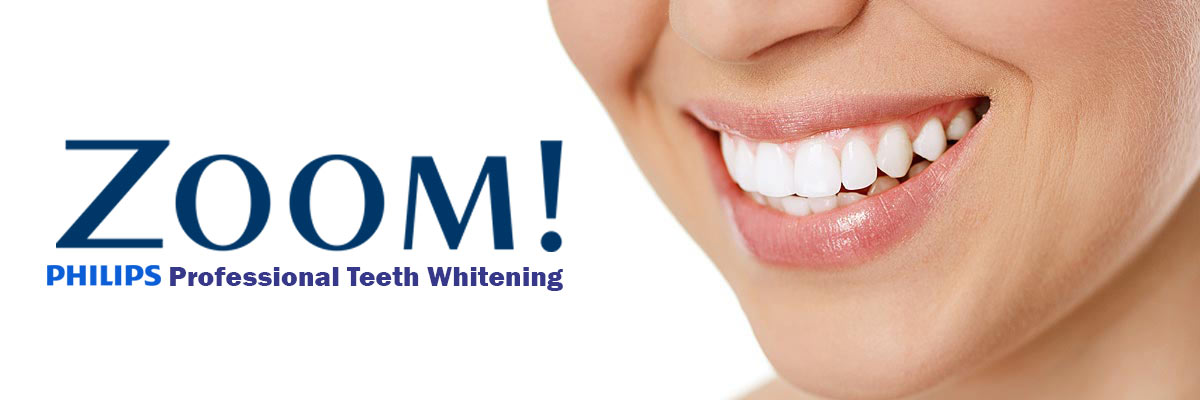 Pomona Zoom Teeth Whitening